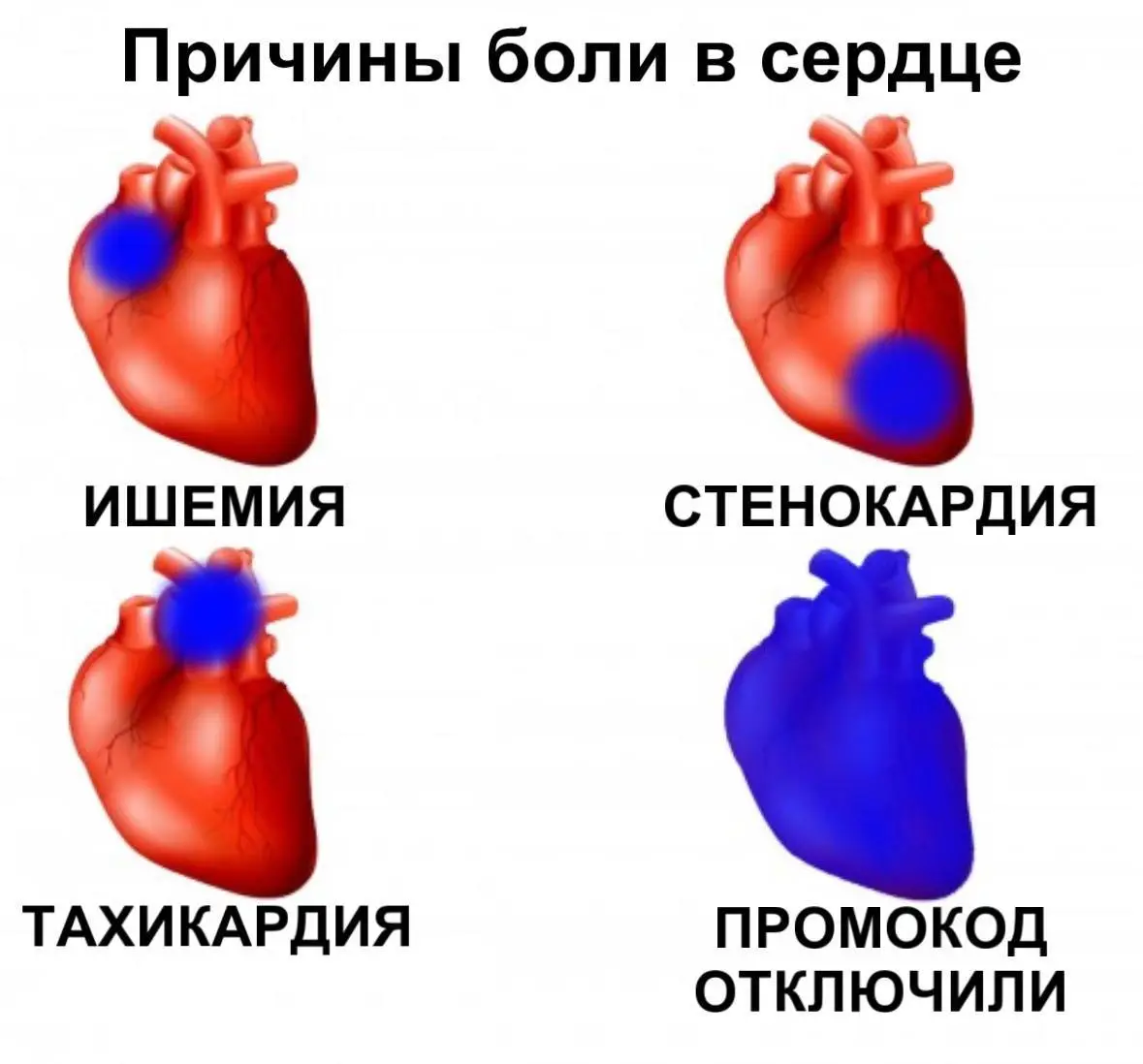 нет промиков.webp
