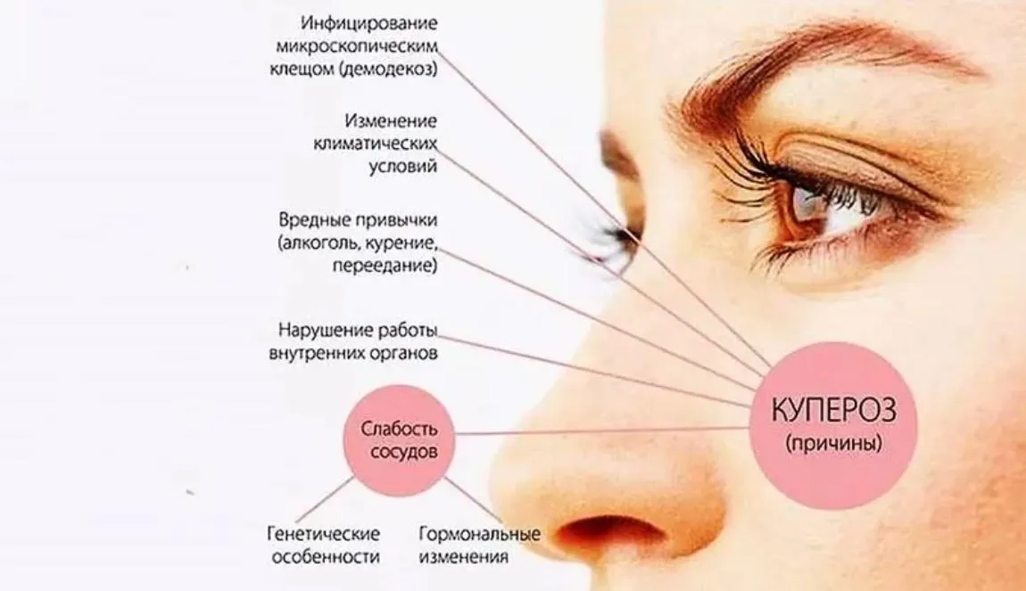 Снимок.JPG