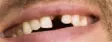 upload_2016-9-26_10-49-2.webp