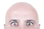 Oblyisenie.webp