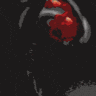 Stigmata07